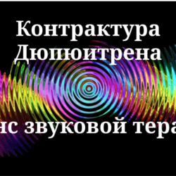 Контрактура Дюпюитрена _ Сеанс звукотерапии