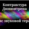 Контрактура Дюпюитрена _ Сеанс звукотерапии