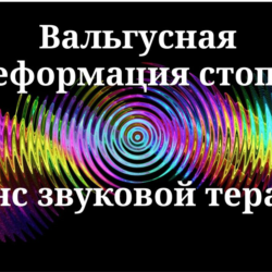 Вальгусная деформация стопы _ Сеанс звукотерапии