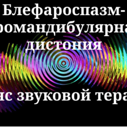 Блефароспазм-оромандибулярная дистония