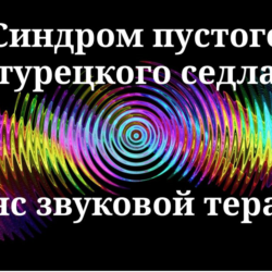 Синдром пустого турецкого седла _Сеанс звуковой терапии