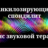Анкилозирующий спондилит — сеанс звуковой терапии