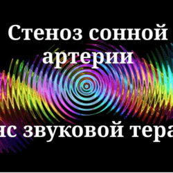 Стеноз сонной артерии — сеанс звуковой терапии