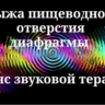 Грыжа пищеводного отверстия диафрагмы